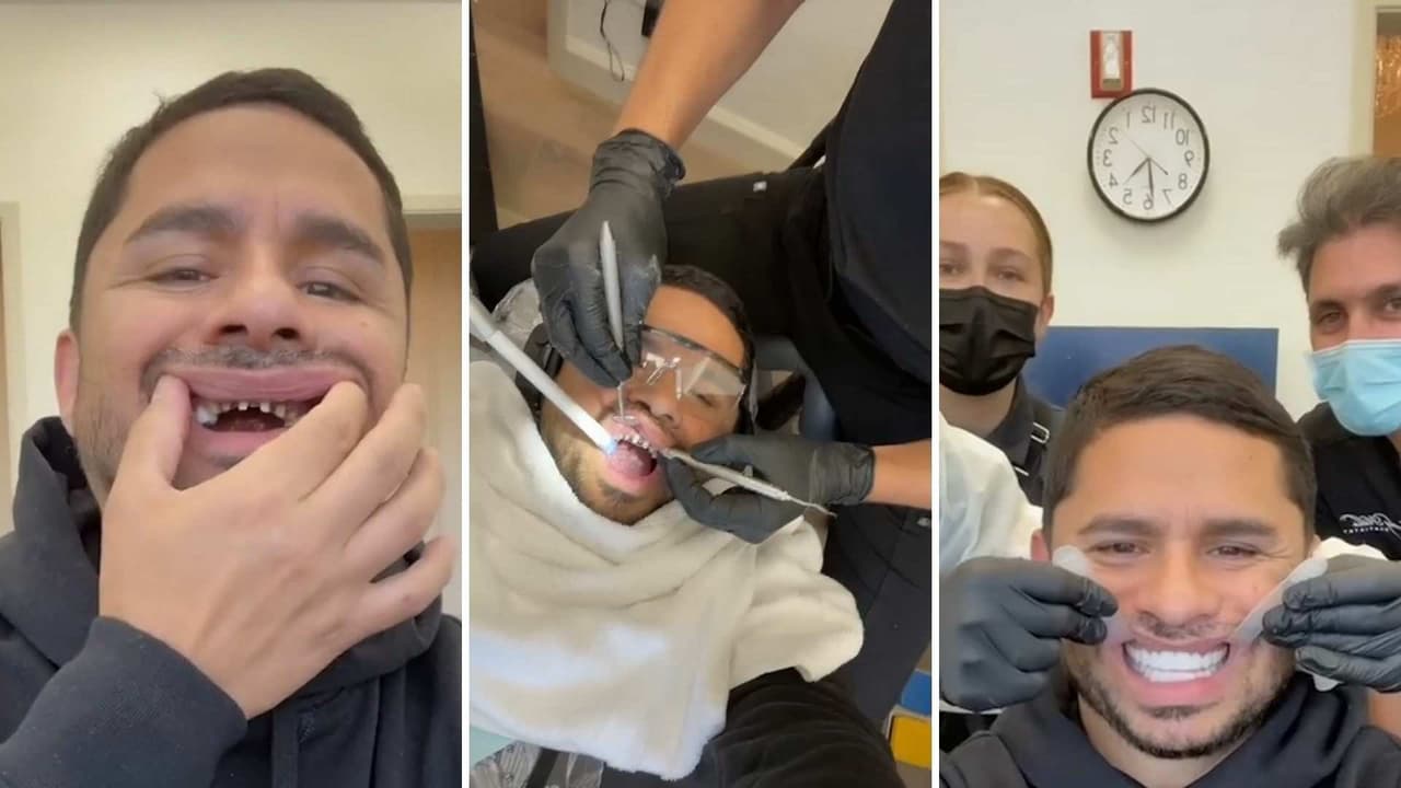 Tras perder sus dientes frontales, Larry Hernández presume su nueva sonrisa con carillas dentales