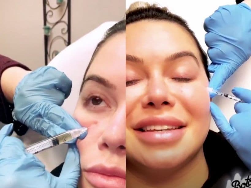 Chiquis Rivera se aplica Toxina Butulinica y PRP para eliminar las arrugas de su rostro.