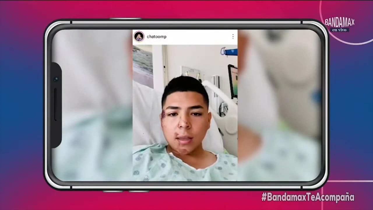 Chato, de Marca MP, habló sobre su estado de salud tras accidente automovilístico