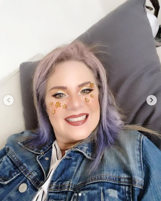 Erika Buenfil se somete a "retoque" estético antes de Navidad (y publica la evidencia)
