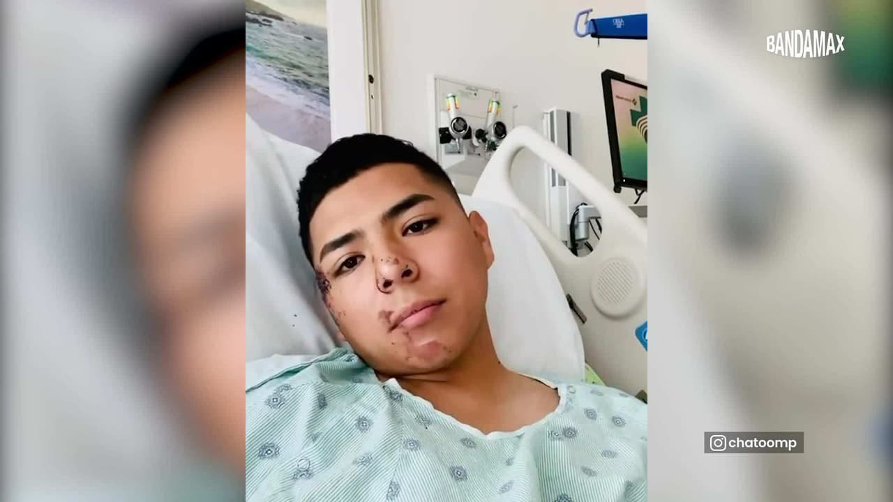 “Dios me dio otra oportunidad de vida”: Chato, del grupo Marca MP, agradece los mensajes de apoyo de sus seguidores