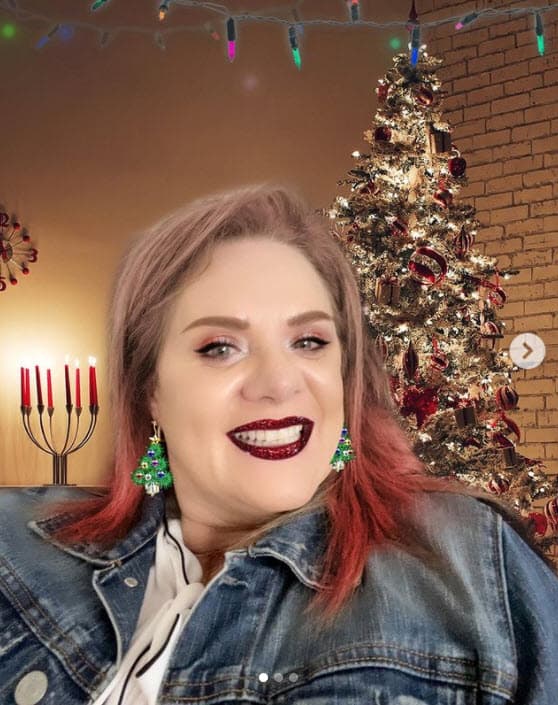 Erika Buenfil se somete a "retoque" estético antes de Navidad (y publica la evidencia)
