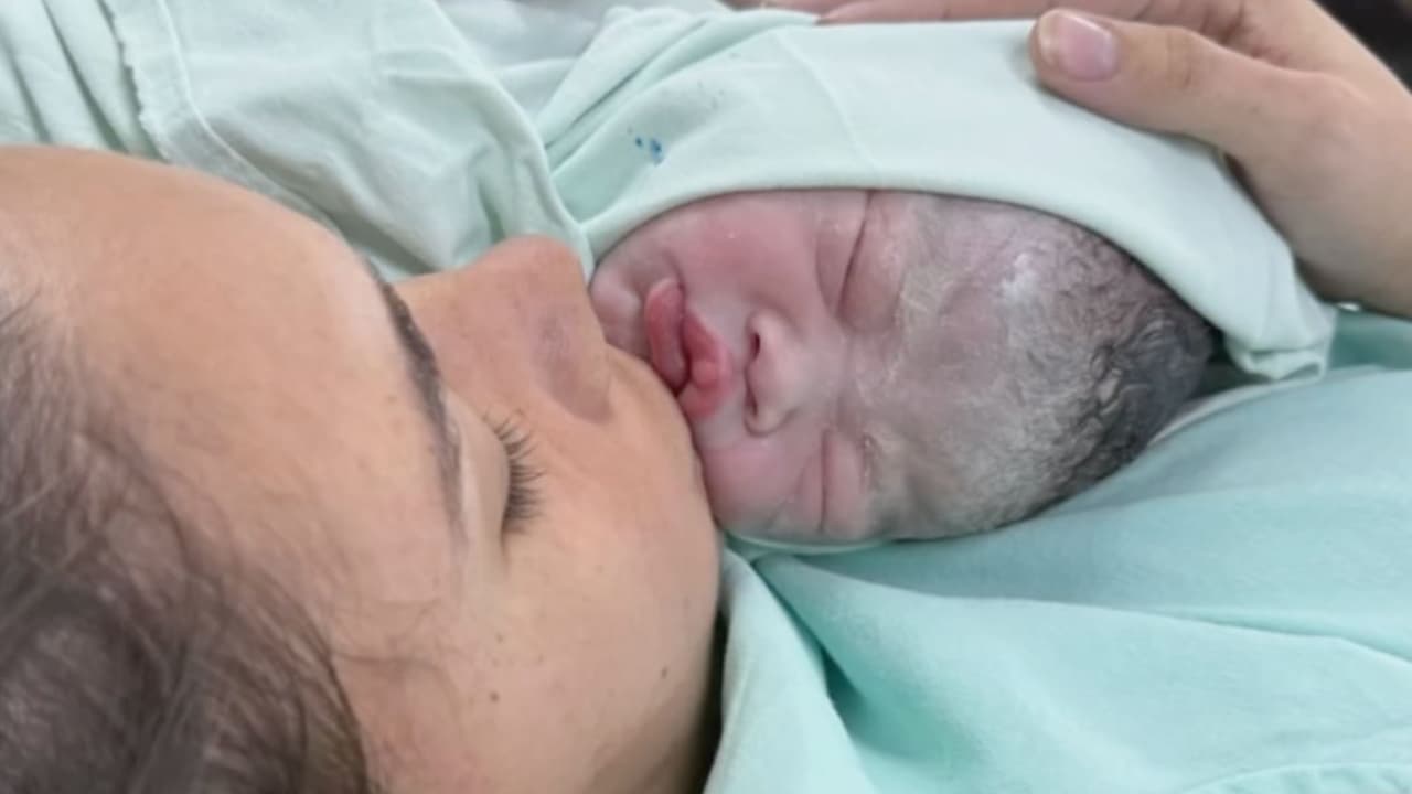 Bebé hispana es operada con éxito dentro del vientre de su madre: tenía una rara condición digestiva