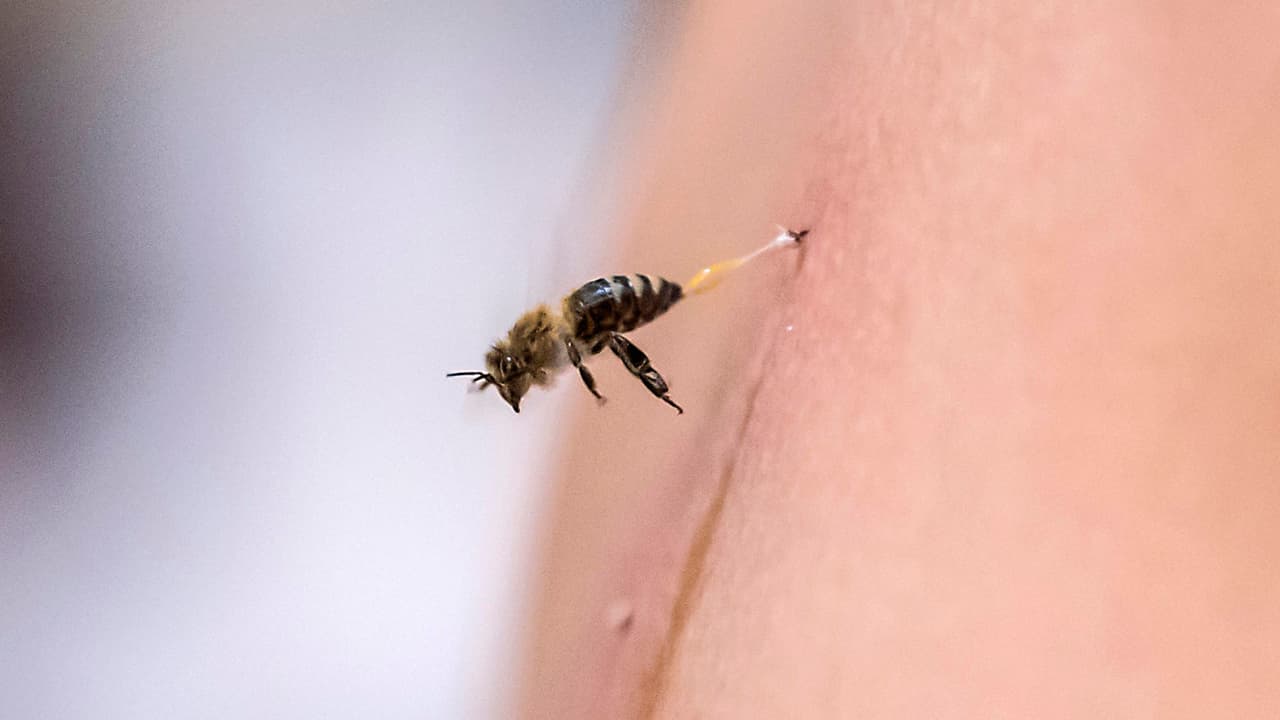 ¿Cómo saber si una picadura de insecto es peligrosa? Te explicamos cuándo debes ir al médico
