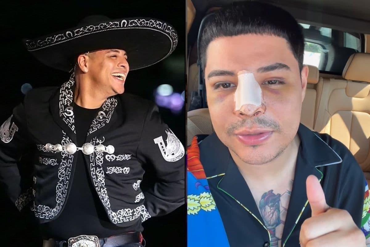 Eduin Caz fue operado de una sinusitis crónica que padecía.